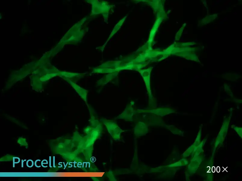 U-87 MG-GFP Cell Complete Medium - small - 4