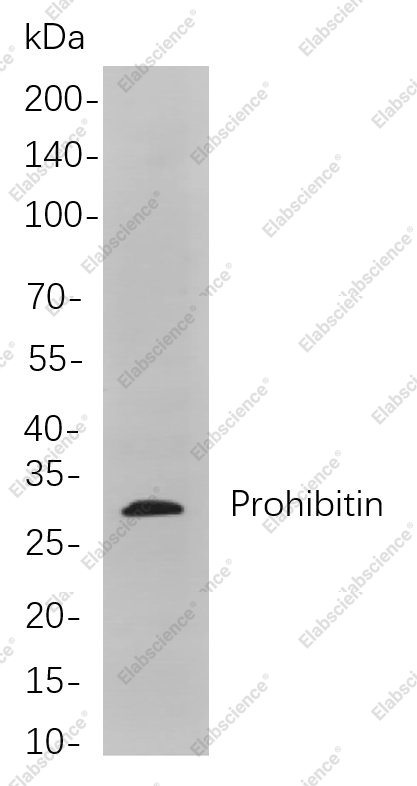 Recombinant Prohibitin Monoclonal Antibody - 1