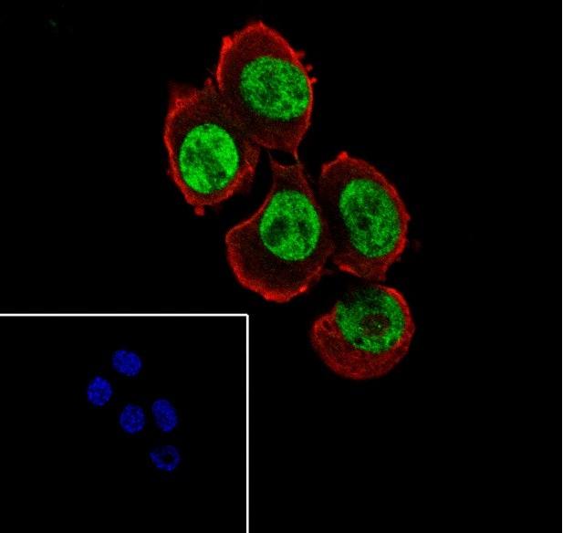 Recombinant QKI Monoclonal Antibody - 3