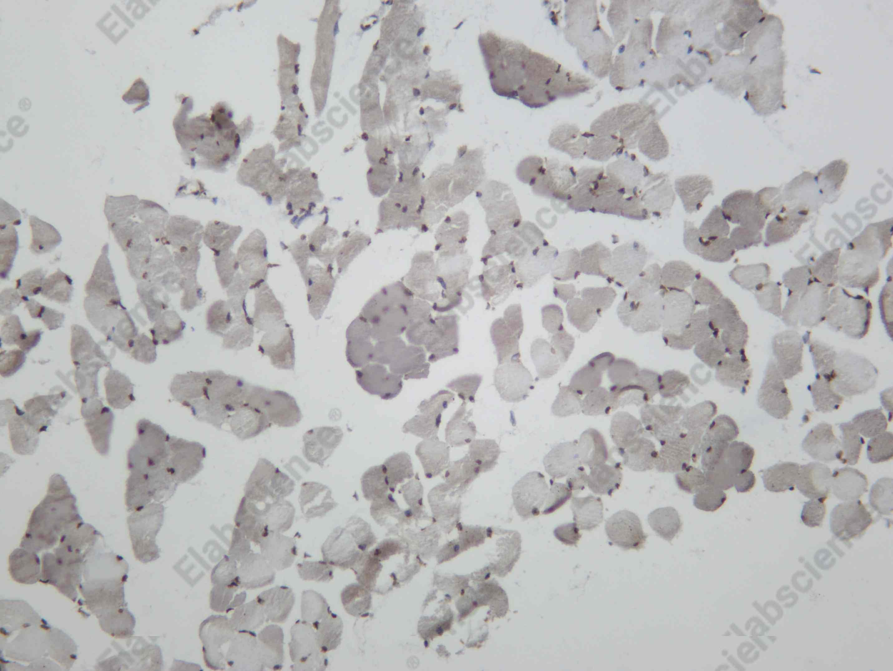 Recombinant IRAK4 Monoclonal Antibody - 4