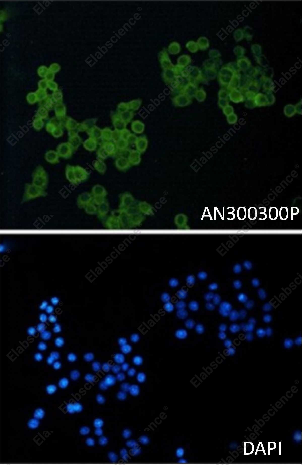 Recombinant CD146/MCAM Monoclonal Antibody - 2