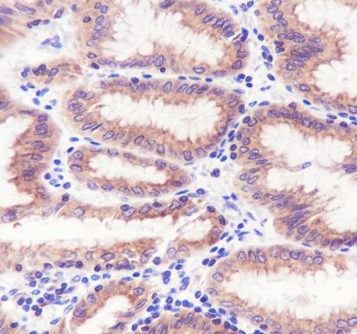 Recombinant Rab8A Monoclonal Antibody - small - 2