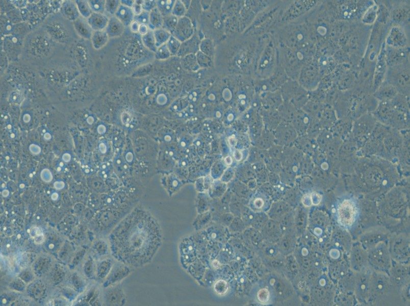 HARA-B Cell Complete Medium - 5