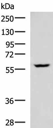 Western blot analysis of LOVO cell lysate  using PDCD4 Polyclonal Antibody at dilution of 1:400