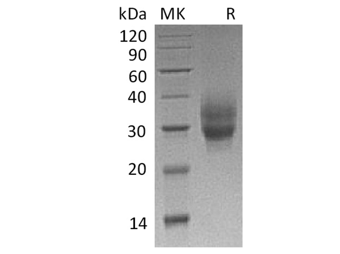Recombinant Cynomolgus 4-1BB/TNFRSF9/CD137 Protein (His Tag)