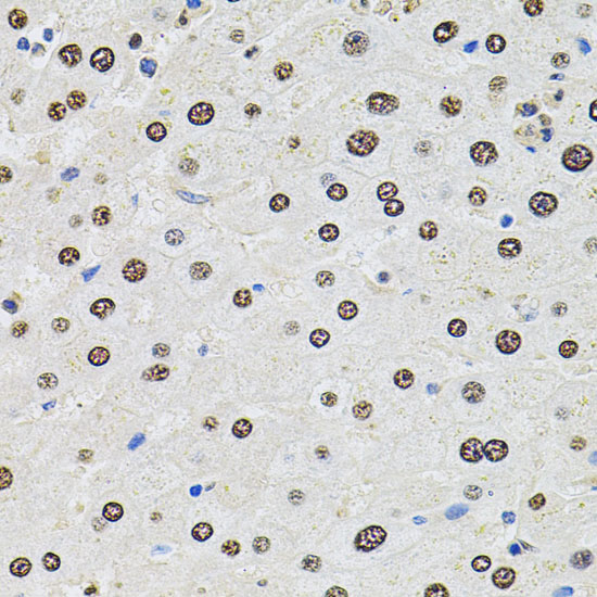 Immunohistochemistry of paraffin-embedded Human liver damage using U2SURP Polyclonal Antibody at dilution of  1:100 (40x lens).