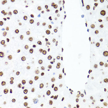 Immunohistochemistry of paraffin-embedded Rat liver using Histone H1.0 Polyclonal Antibody at dilution of 1:100 (40x lens).