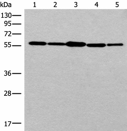 Western blot analysis of 293T cell HUVEC cell Hela cell lysates  using RAD23B Polyclonal Antibody at dilution of 1:350