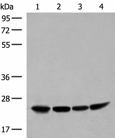 Western blot analysis of Human fetal liver tissue HepG2 K562 and Raji cell lysates  using DTYMK Polyclonal Antibody at dilution of 1:400