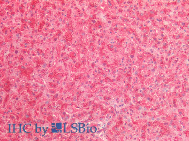 Immunohistochemistry of paraffin-embedded Human Liver using Cathepsin B Polyclonal Antibody at dilution of 1:80(Elabscience Product Detected by Lifespan).