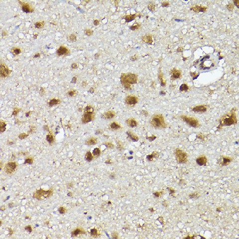 Immunohistochemistry of paraffin-embedded rat brain using UBQLN4 Polyclonal Antibody at dilution of 1:100 (40x lens).Perform high pressure antigen retrieval with 10 mM citrate buffer pH 6.0 before commencing with IHC staining protocol.