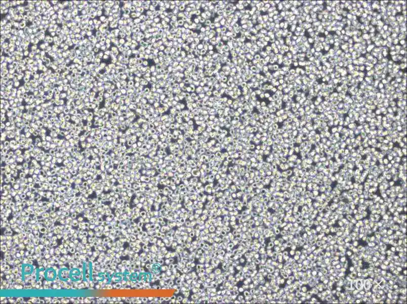 NB4 Cell Complete Medium - 1