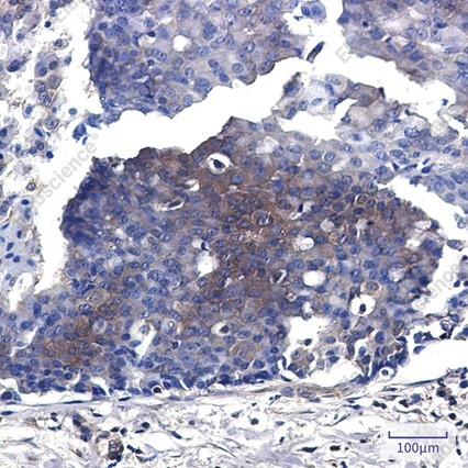 Recombinant MEK2 Monoclonal Antibody - 4