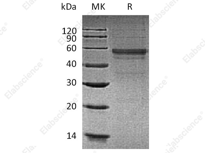 Recombinant Human GLP1R Protein (Fc Tag) - 1