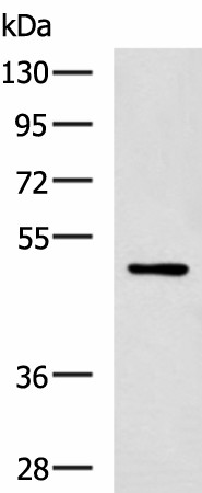 Western blot analysis of MCF-7 cell lysate  using PAX2 Polyclonal Antibody at dilution of 1:400