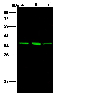 Recombinant AKR1B1 Monoclonal Antibody - small - 3