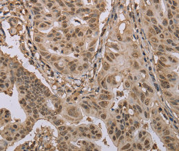 CAB39 Polyclonal Antibody - 3