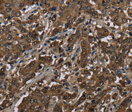 GSTP1 Polyclonal Antibody - 2