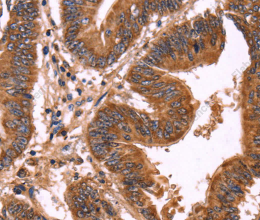 ERP29 Polyclonal Antibody - 2