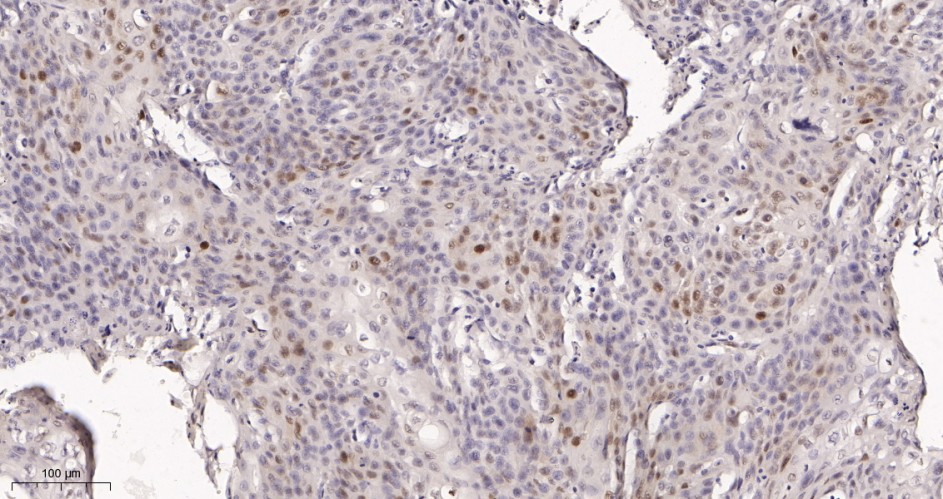 Recombinant p21 Monoclonal Antibody - small - 2