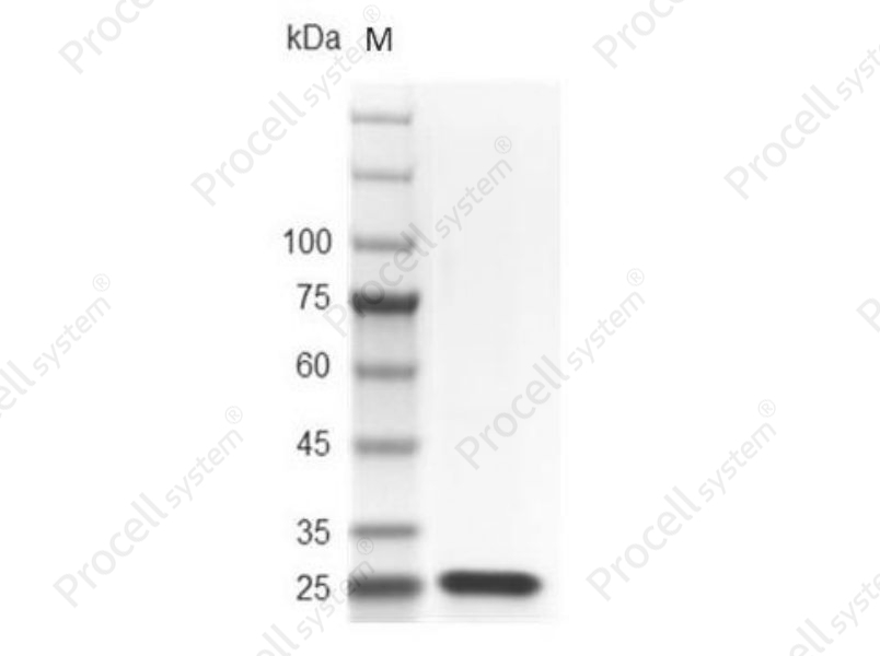 FGF-21/FGFL, Mouse, Recombinant