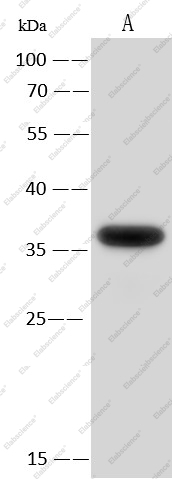 EMAPII/AIMP1 Monoclonal Antibody - 1