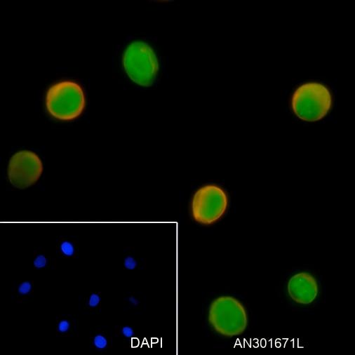 Recombinant TCL1 Monoclonal Antibody - small - 4