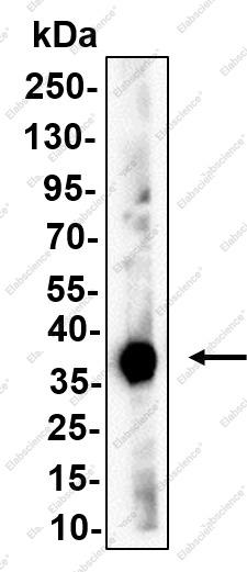 Recombinant HuD/HuC Monoclonal Antibody - 1