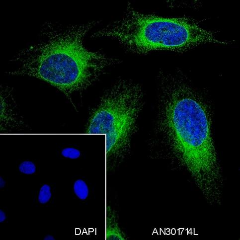 Recombinant BAP29 Monoclonal Antibody - small - 4