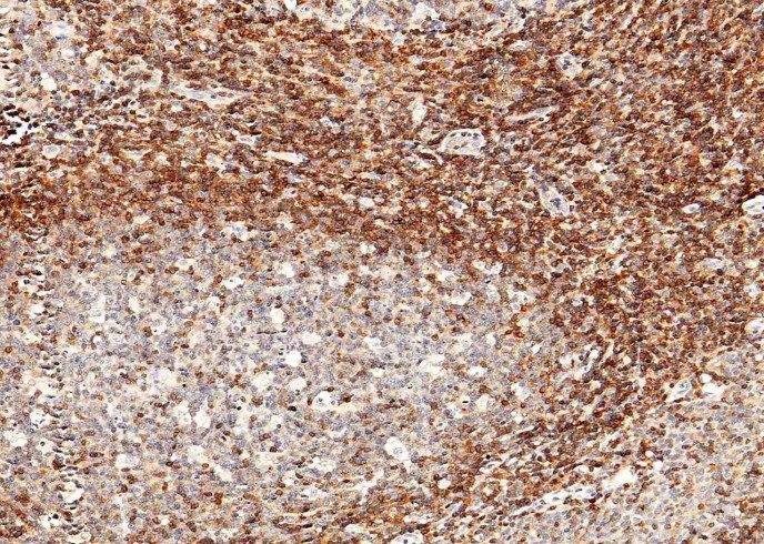 Recombinant IL-16 Monoclonal Antibody-searchlist-1