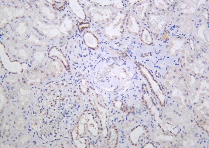 Recombinant Nibrin Monoclonal Antibody - 2