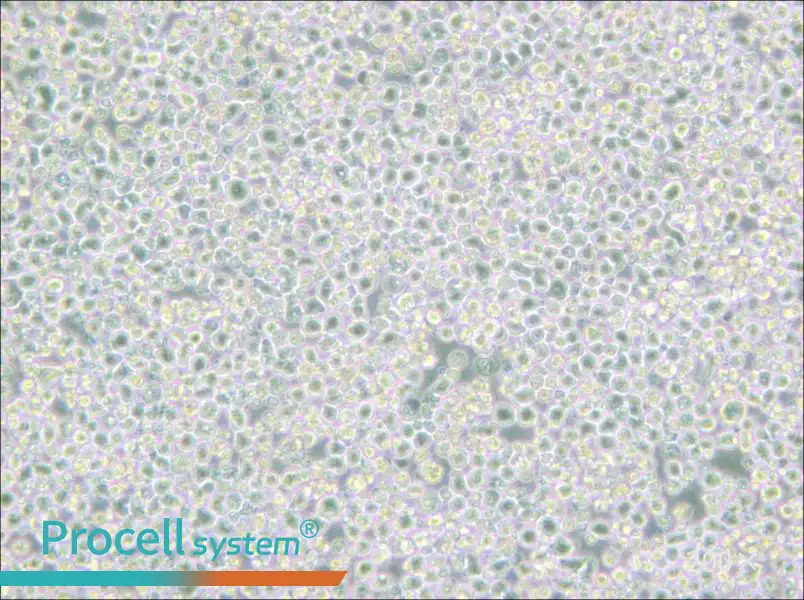 PC 61 5.3 [PC 61; PC 61.5.3] Cell Complete Medium - 4