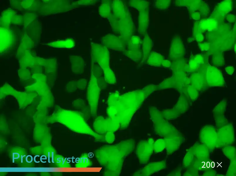 NCI-H446-LUC-EGFP Cell Complete Medium - 5
