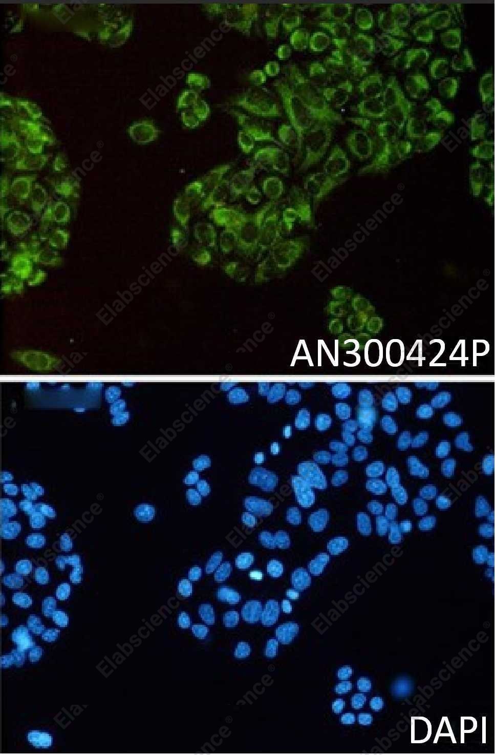 Recombinant Thioredoxin-2/TXN2 Monoclonal Antibody - 5