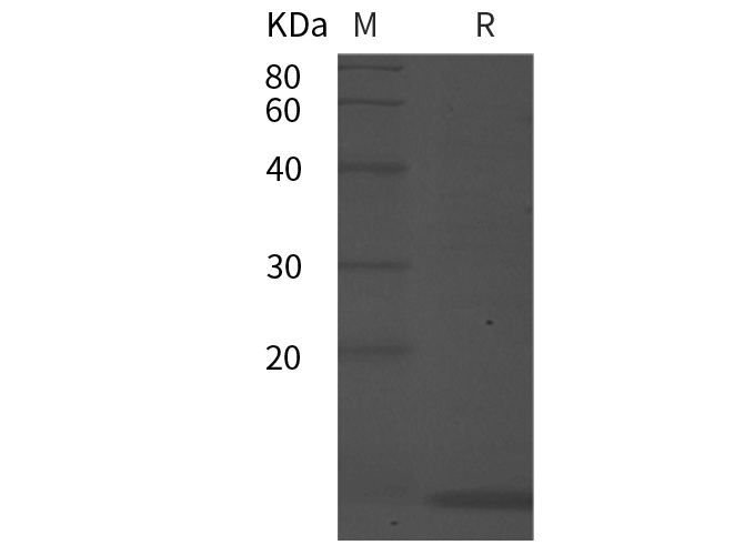 Recombinant Human CXCL10 Protein(His Tag)-1
