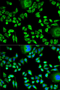 Immunofluorescence analysis of HeLa cells using CSTA Polyclonal Antibody