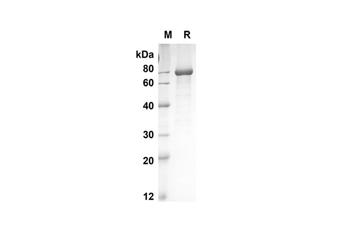 Recombinant Human TNFa Protein(Avi, His Tag)-产品推荐-1