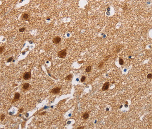 Immunohistochemistry of paraffin-embedded Human brain tissue using ATXN1 Polyclonal Antibody at dilution 1:40