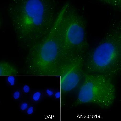 Recombinant Factor XIIIa Monoclonal Antibody - small - 6