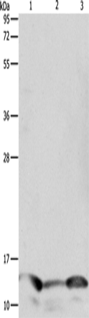 Western Blot analysis of Human seminoma tissue, hela and A549 cell using PFN1 Polyclonal Antibody at dilution of 1:1000