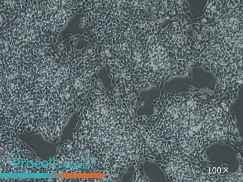 A-673 Cell Complete Medium - 1