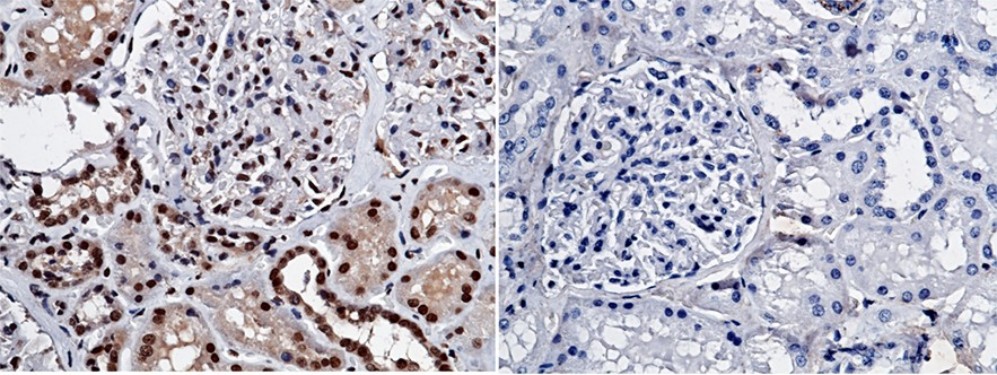 NBL1/DAND1/DAN Monoclonal Antibody - small - 3
