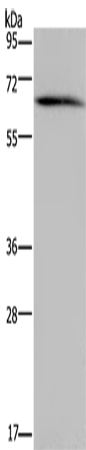 Western Blot analysis of Human brain malignant glioma tissue using NCF2 Polyclonal Antibody at dilution of 1:200