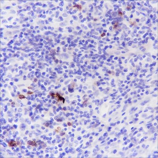 Recombinant CD134/OX40 Monoclonal Antibody-searchlist-1