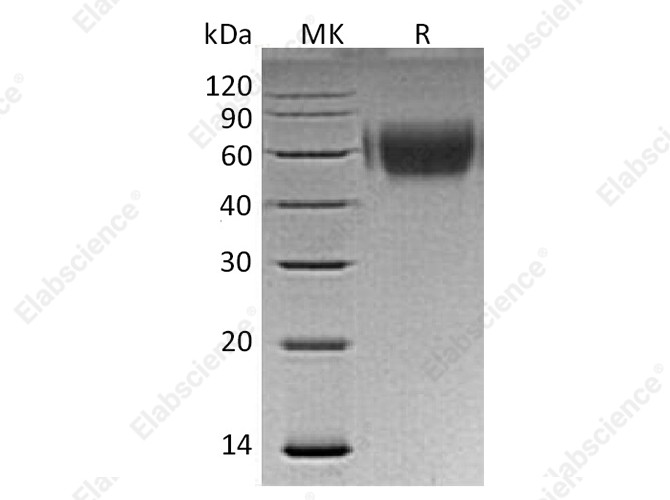 Recombinant Human MICA Protein (His Tag) - 1