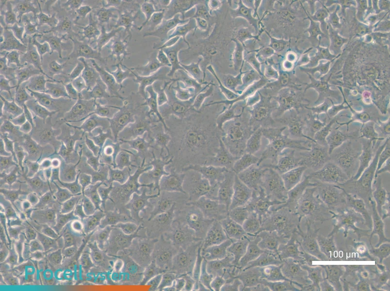 B16-F10-GFPB16-F10-GFP - 3