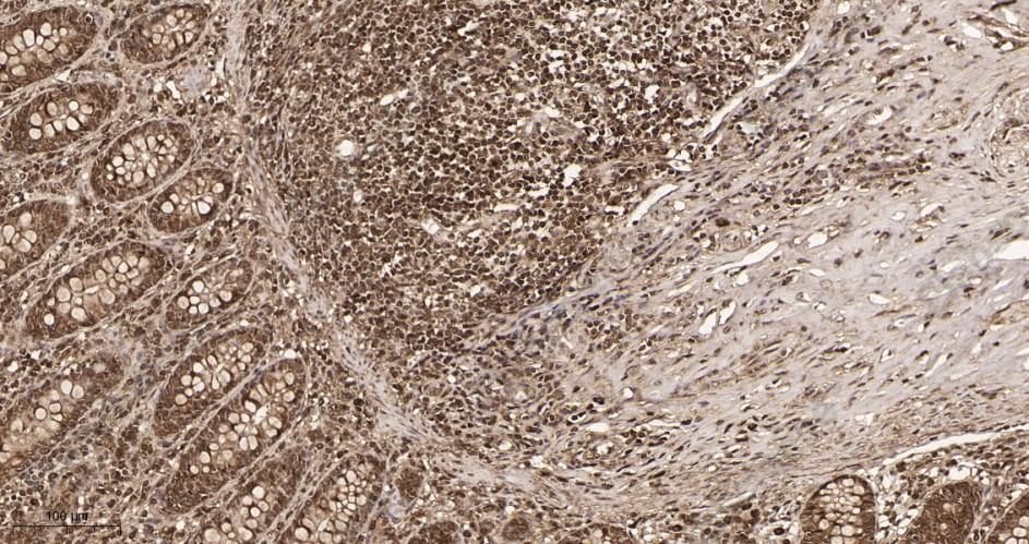 Recombinant Lactate Dehydrogenase Isoenzyme V Monoclonal Antibody - 2