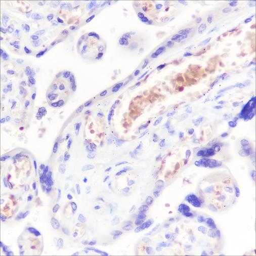 Recombinant Hemoglobin alpha Monoclonal Antibody - 2