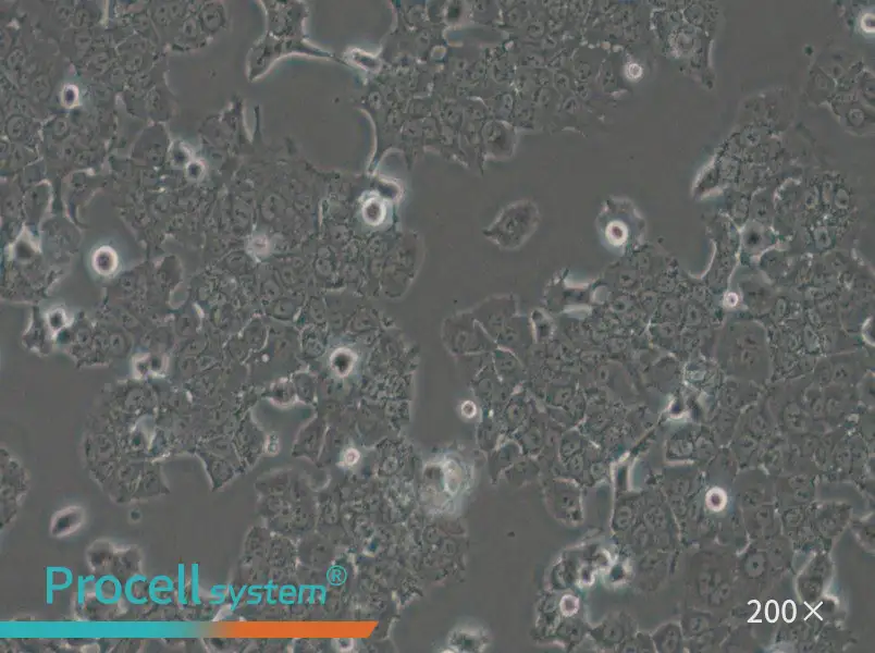 NCI-H1573 Cell Complete Medium - small - 6