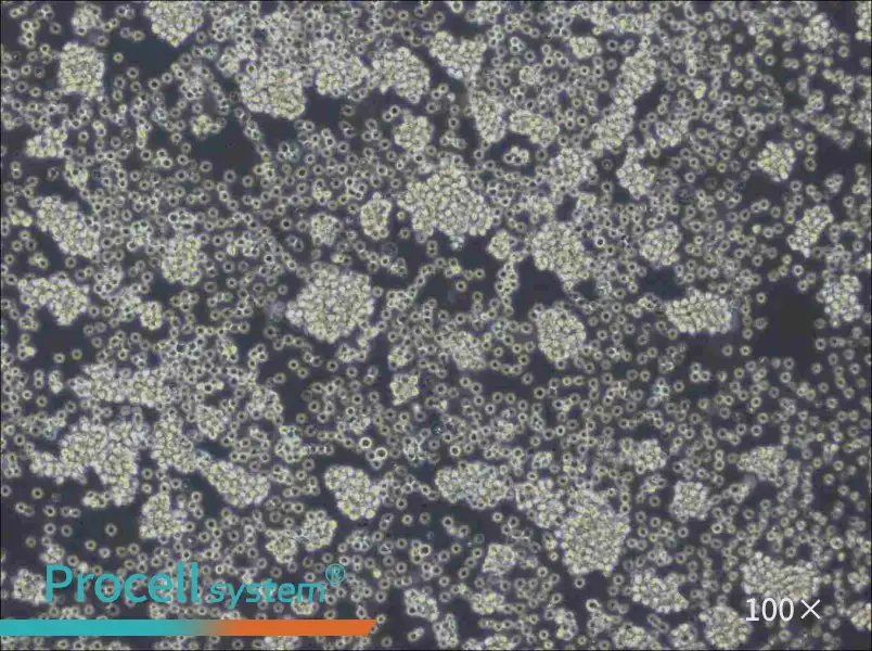 WSU-DLCL2 Cell Complete Medium - 2